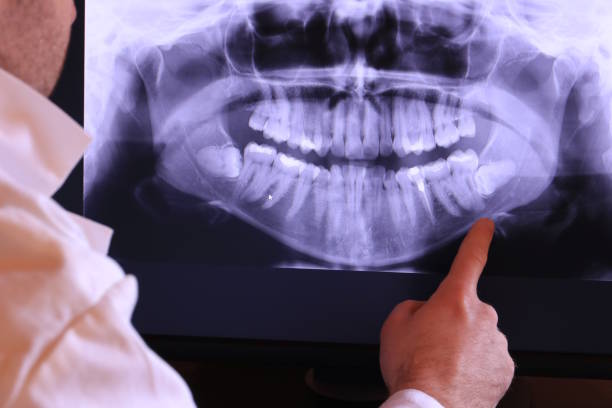 Best Emergency Root Canal Treatment in Rock Rapids, IA